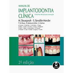 Livro - Manual de Implantodontia Clinica: Conceitos, Protocolos e Inovações é bom? Vale a pena?