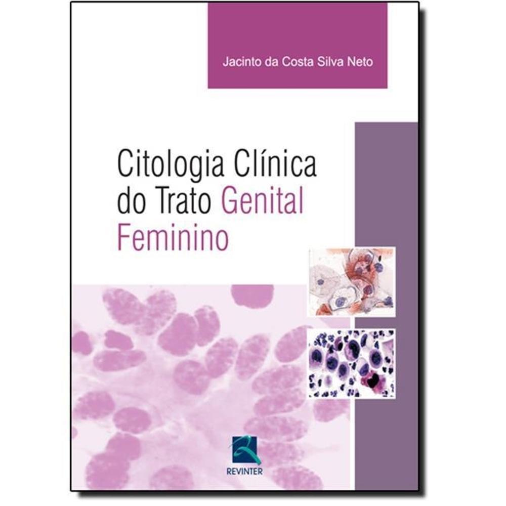 Citologia Clinica Do Trato Genital Feminino é bom? Vale a pena?