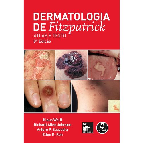 Dermatologia de Fitzpatrick é bom? Vale a pena?