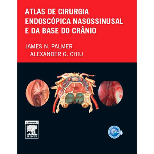 Livro - Atlas de Cirurgia Endoscópica Nasossinusal e da Base do Crânio é bom? Vale a pena?