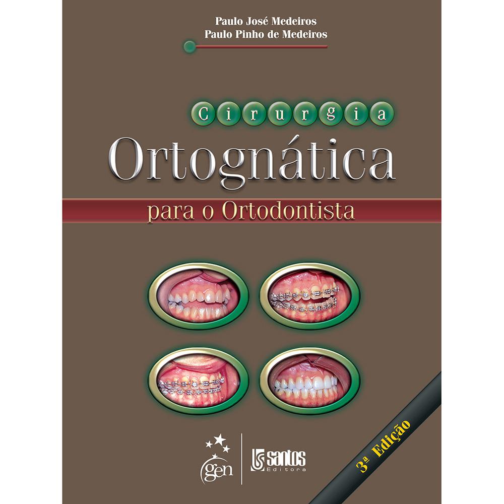 Livro - Cirurgia Ortognática para o Ortodontista é bom? Vale a pena?