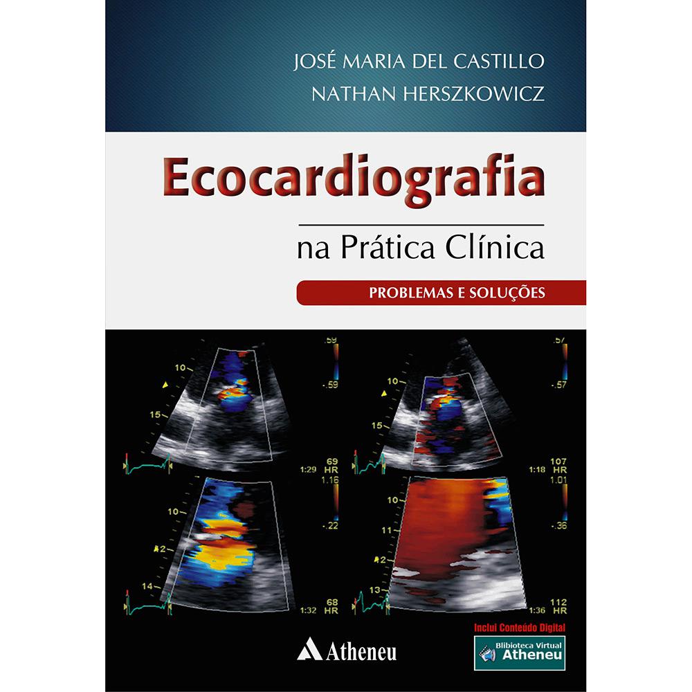 Livro - Ecocardiografia na Prática Clínica - Problemas e Soluções é bom? Vale a pena?