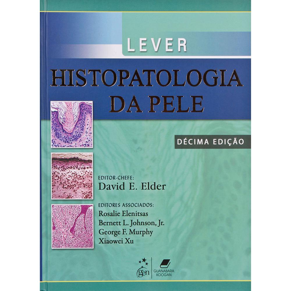 Livro - Lever : Histopatologia da Pele é bom? Vale a pena?