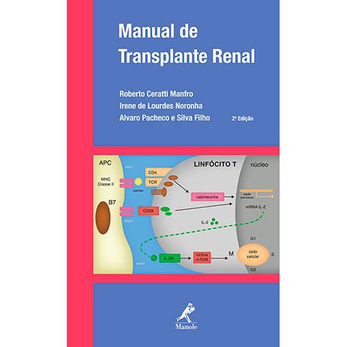 Livro - Manual de Transplante Renal é bom? Vale a pena?