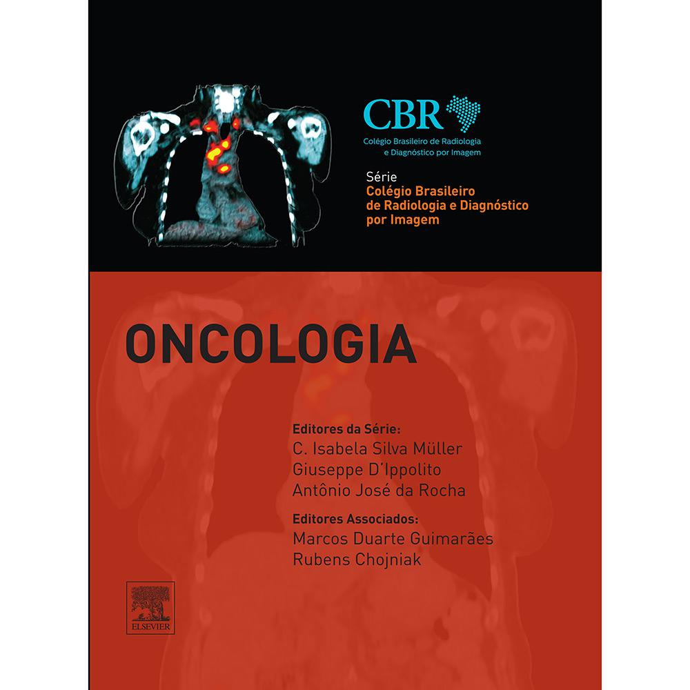 Livro - Oncologia - Série Colégio Brasileiro de Radiologia e Diagnóstico por Imagem é bom? Vale a pena?