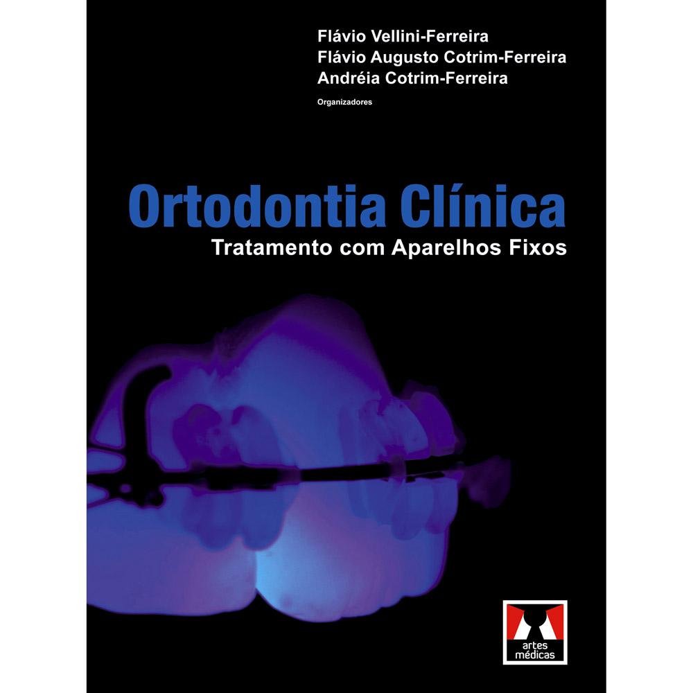 Livro - Ortodontia Clínica: Tratamento Com Aparelhos Fixos é bom? Vale a pena?