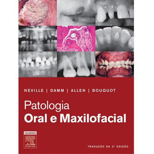 Livro - Patologia Oral e Maxilofacial é bom? Vale a pena?