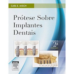 Livro - Prótese Sobre Implantes Dentais é bom? Vale a pena?