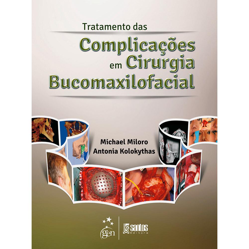 Livro - Tratamento das Complicações em Cirurgia Bucomaxilofacial é bom? Vale a pena?