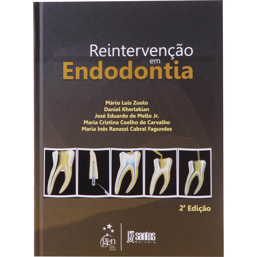 Reintervenção em Endodontia é bom? Vale a pena?