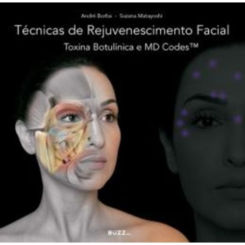 Tecnicas de Rejuvenescimento Facial - Toxina Botulinica e Md Codes é bom? Vale a pena?