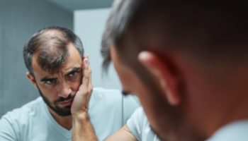Queda de Cabelos Masculino: Causas e Tratamentos e Soluções